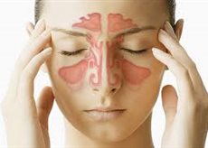 Balloon Sinuplasty | Causes | Treatment | HASC Image eClassifieds4u