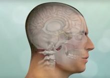 Get Sinonasal tumors Surgery done at HASC Image eClassifieds4U