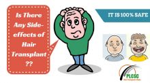 5 Facts about the After Effects of Hair Transplant That Are No Big Deal Image eClassifieds4u 3