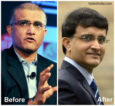 Hair Loss – Men Vs Women Image eClassifieds4u