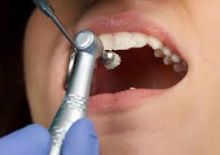 Dentist in San Mateo CA Image eClassifieds4u 3