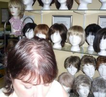 Wigs & Hair Pieces for Hair Loss also a Turn Key Business Opportunity Available Image eClassifieds4u 2